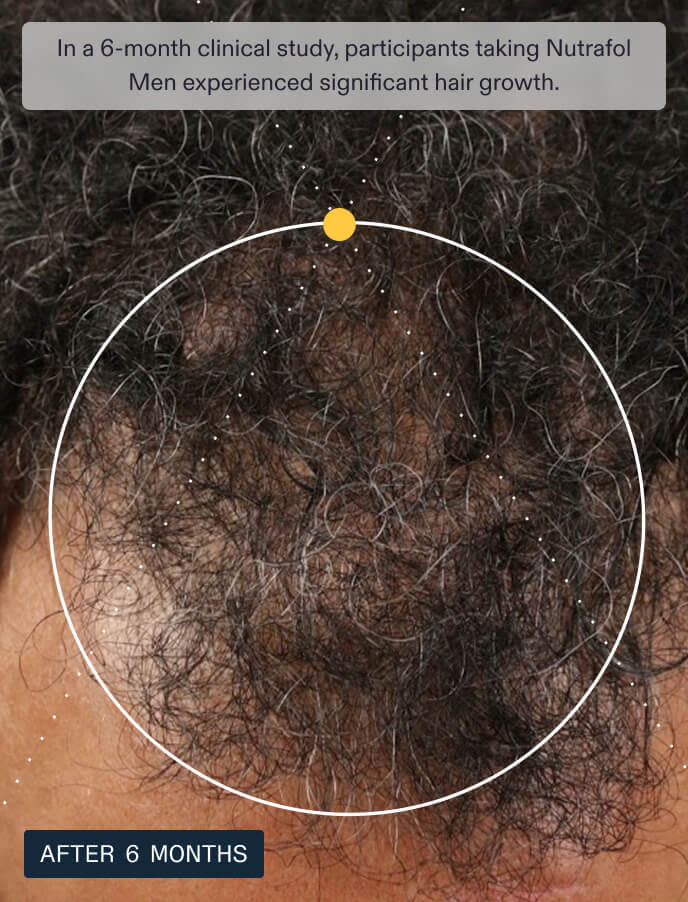 Nutrafol Men (For visibly fuller hair and scalp coverage)