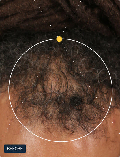 Nutrafol Men (For visibly fuller hair and scalp coverage)